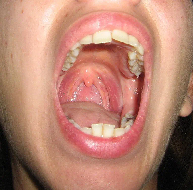 Bouche et Salive Bouche et Salive