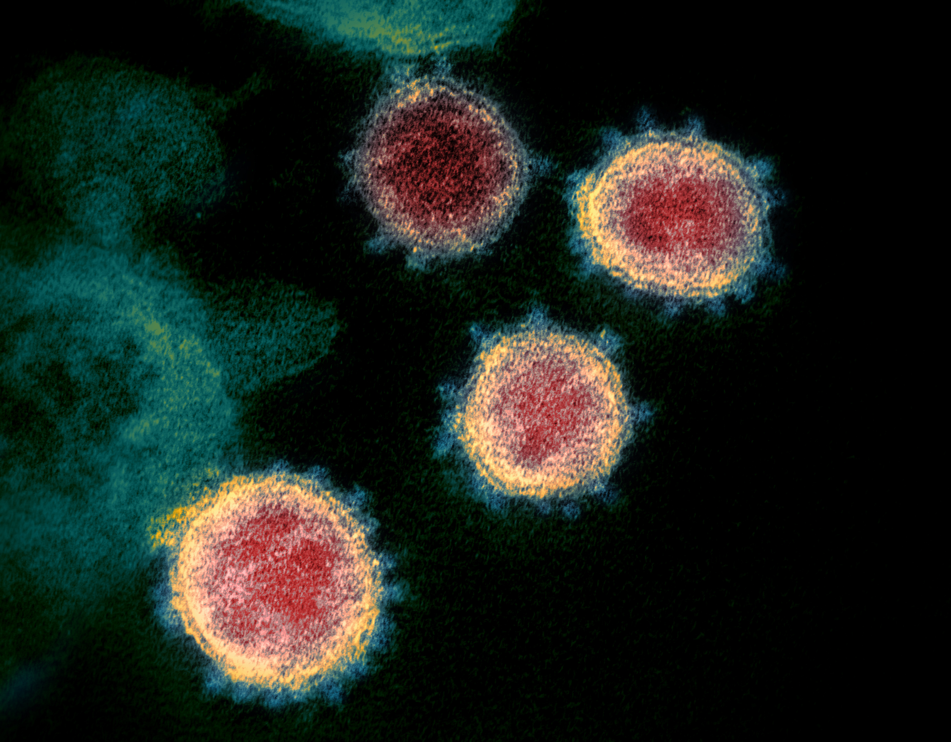 Vue microscopique du virus qui entraîne la maladie du Coronavirus